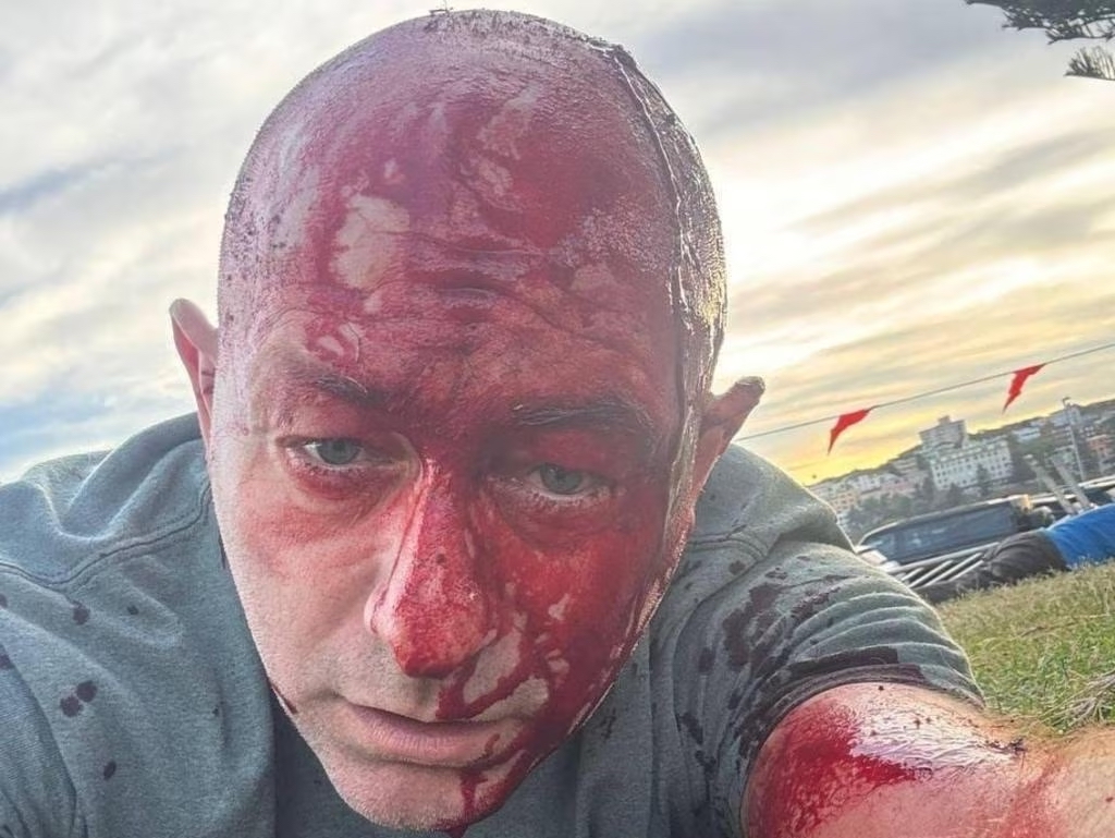 Arsen Ostrovsky took this photo for his family while not knowing if he would survive the attack (Image: Arsen Ostrovsky)