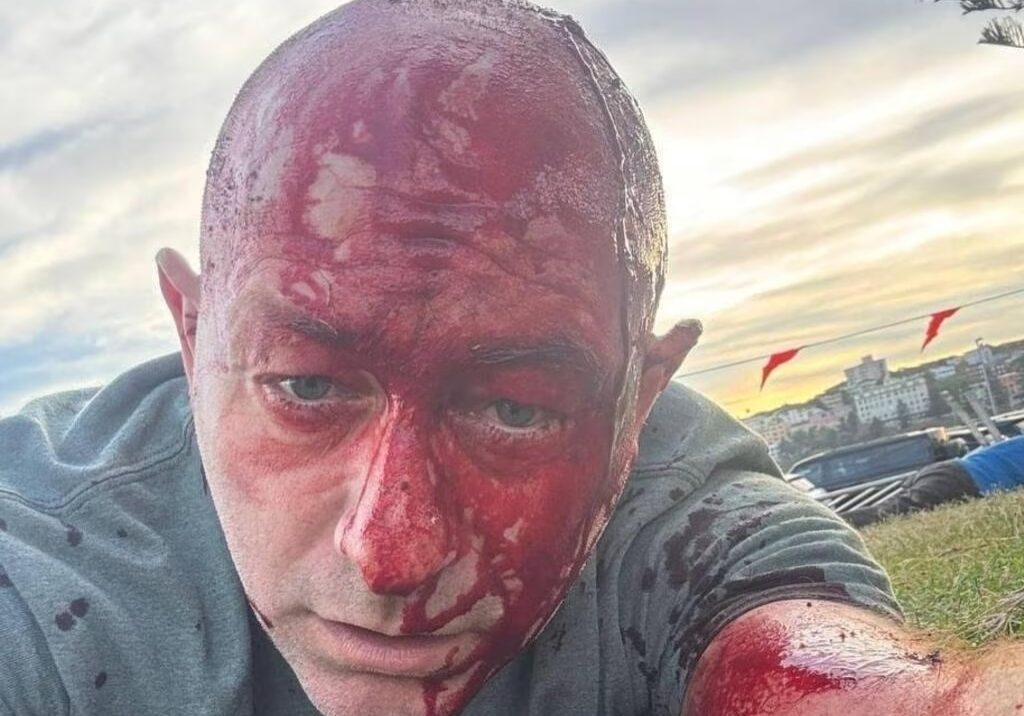 Arsen Ostrovsky took this photo for his family while not knowing if he would survive the attack (Image: Arsen Ostrovsky)